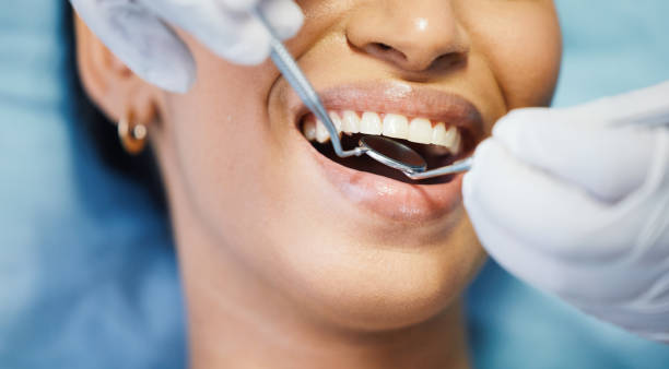 Best Emergency Denture Repair in Castalia, OH