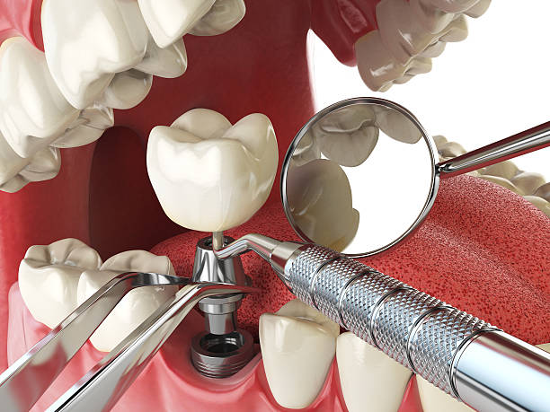 Best Weekend Emergency Dentist in Castalia, OH