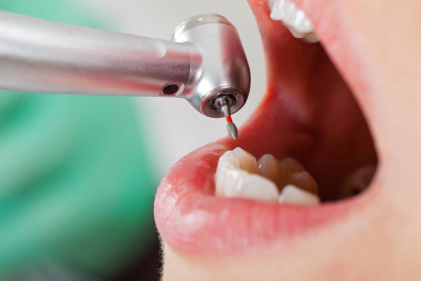 Best After-Hours Dental Trauma Care in Castalia, OH